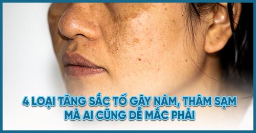 4-loai-tang-sac-to-gay-nam-tham-sam-ai-cung-de-mac-phai