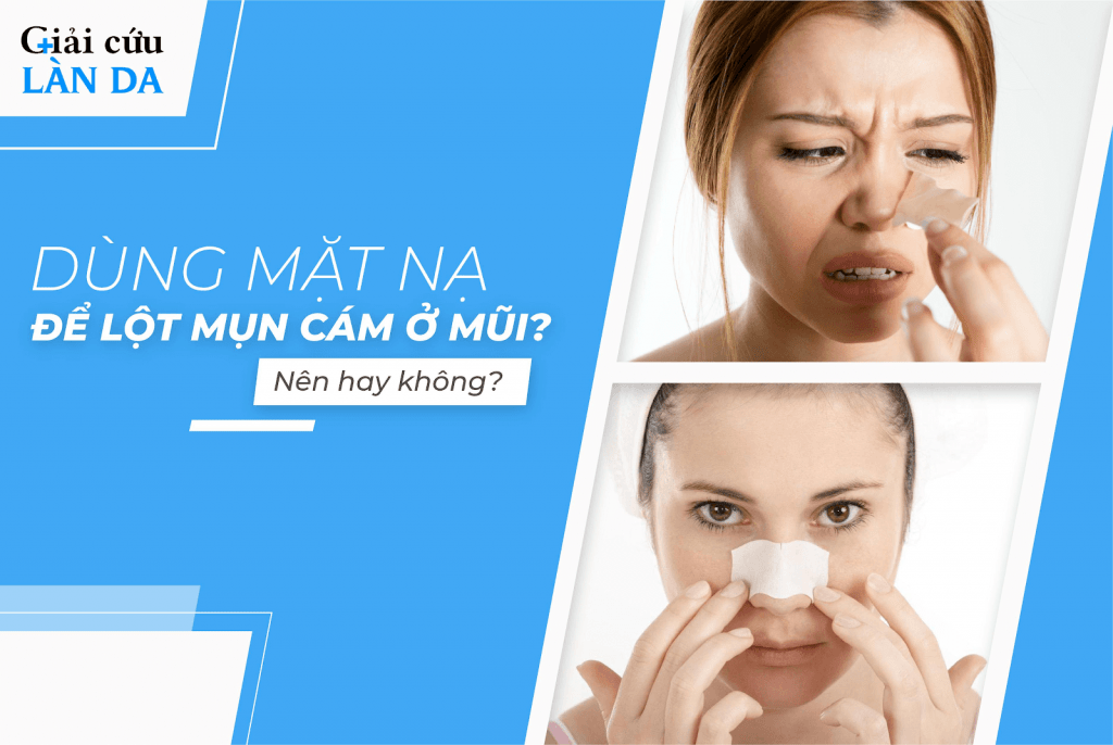 Lột mụn cám ở mũi có nên hay không