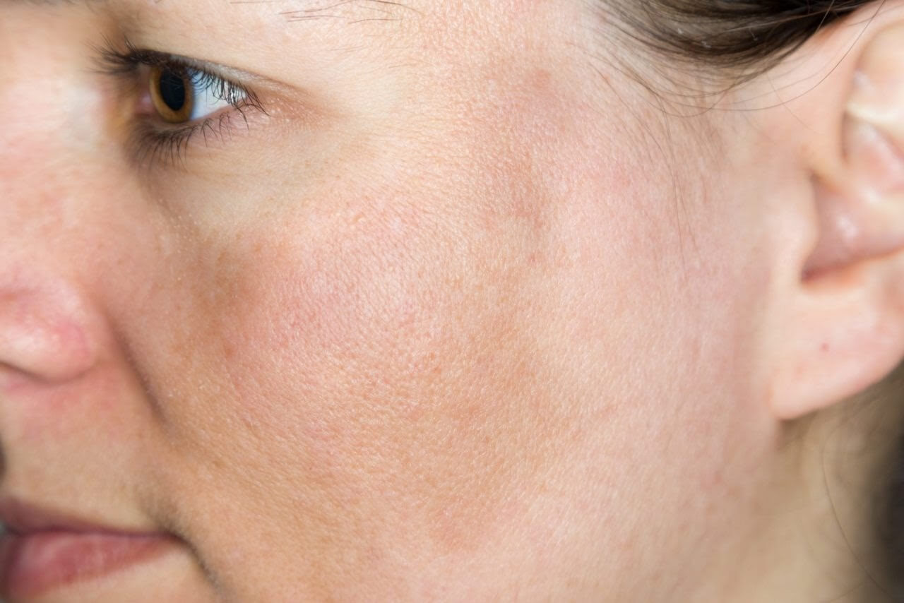 Cách chăm sóc da mặt sau sinh tại nhà và những vấn đề thường gặp