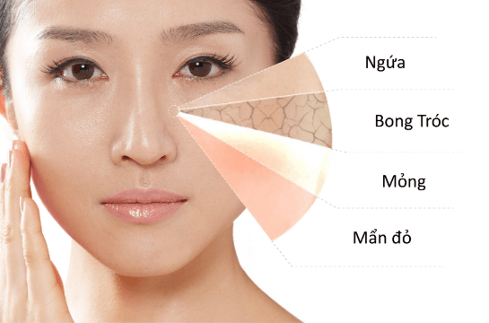 Cần hiểu làn da trước khi tìm kem dưỡng da an toàn hiệu quả