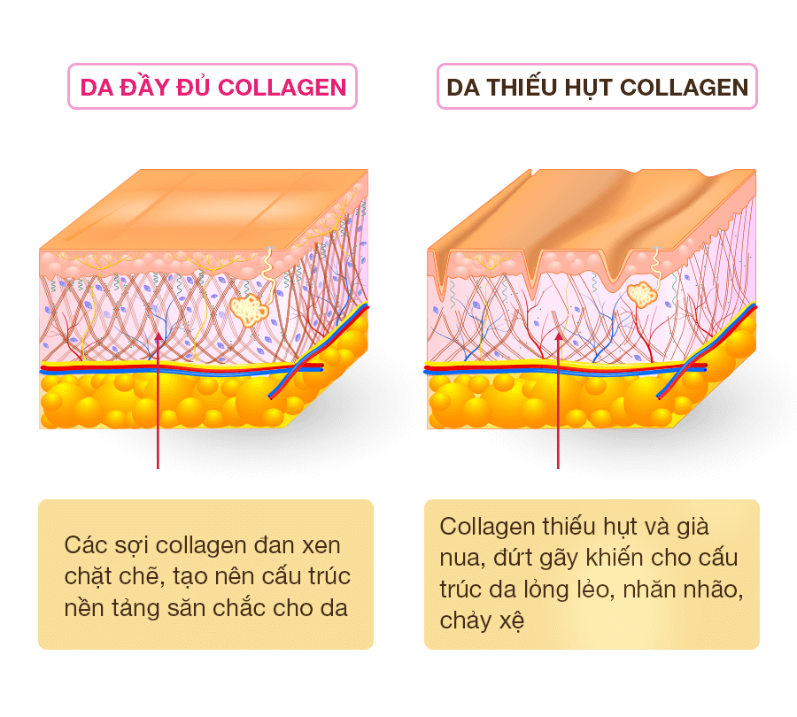 Tình trạng Collagen ở da