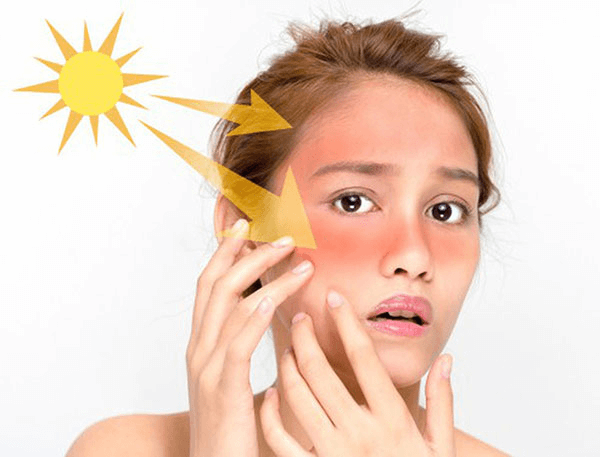 Ánh nắng mặt trời gây tiêu cực cho làn da
